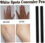 ⁦White Spots Concealer Pen Waterproof Long Lasting Vitiligo Scars Birthmarks Cover Pencil Natural Camouflage Makeup Pen⁩ - الصورة ⁦5⁩