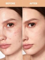 ⁦SHEGLAM Complexion Boost Concealer - With Sponge-head Applicator - High-coverage Formula (Fair)⁩ - الصورة ⁦2⁩