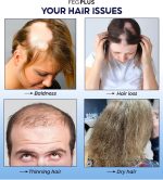 ⁦FEGPLUS Hair & Beard Growth Serum, 22% Seaweed Extract Rosemary, Redensyl, Anagain & Minoxidil 5% for Hair Growth Booster, Thicker, Longer and Stronger Hair Spray 50ml⁩ - الصورة ⁦4⁩