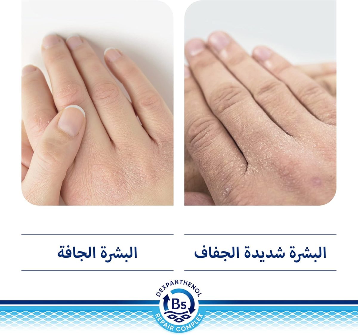 ⁦Bepanthen DERMA Restoring Daily Body Lotion - Moisturising Cream For Sensitive & Dry Skin - Dermatologically Tested - Dexpanthenol - Fragrance, Preservative & Colorant Free - For All Ages, 200ml⁩ - الصورة ⁦10⁩