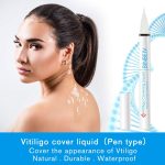 ⁦BINBEIV Vitiligo Cosmetic Camouflage Liqui, Cover appearance of Skin Depigmentation, Natural-Durable-Waterproof, Makeup Cover Waterproof, Used on face, hands and body⁩ - الصورة ⁦2⁩