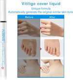 ⁦BINBEIV Vitiligo Cosmetic Camouflage Liqui, Cover appearance of Skin Depigmentation, Natural-Durable-Waterproof, Makeup Cover Waterproof, Used on face, hands and body⁩ - الصورة ⁦5⁩