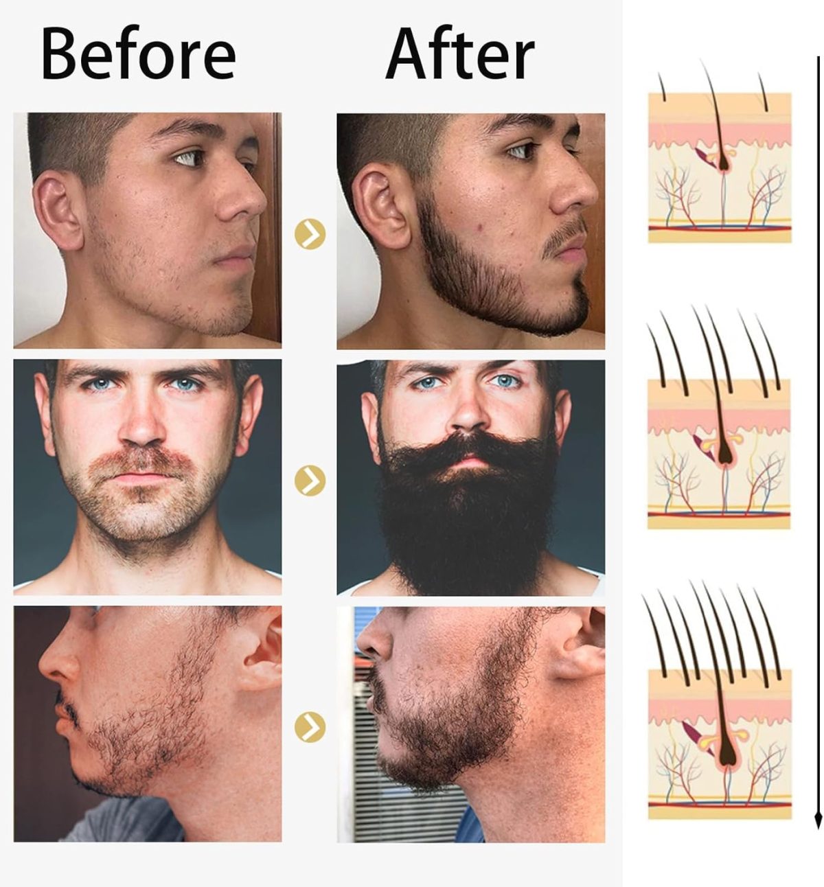 ⁦Beard Growth Serum Kit, Azonee Organic Beard Oil with Tea Tree and Jojoba, 0.5MM Derma Roller for Beard Growth, Nourishing Beard Grooming Set for Fuller and Thicker Beard⁩ - الصورة ⁦5⁩