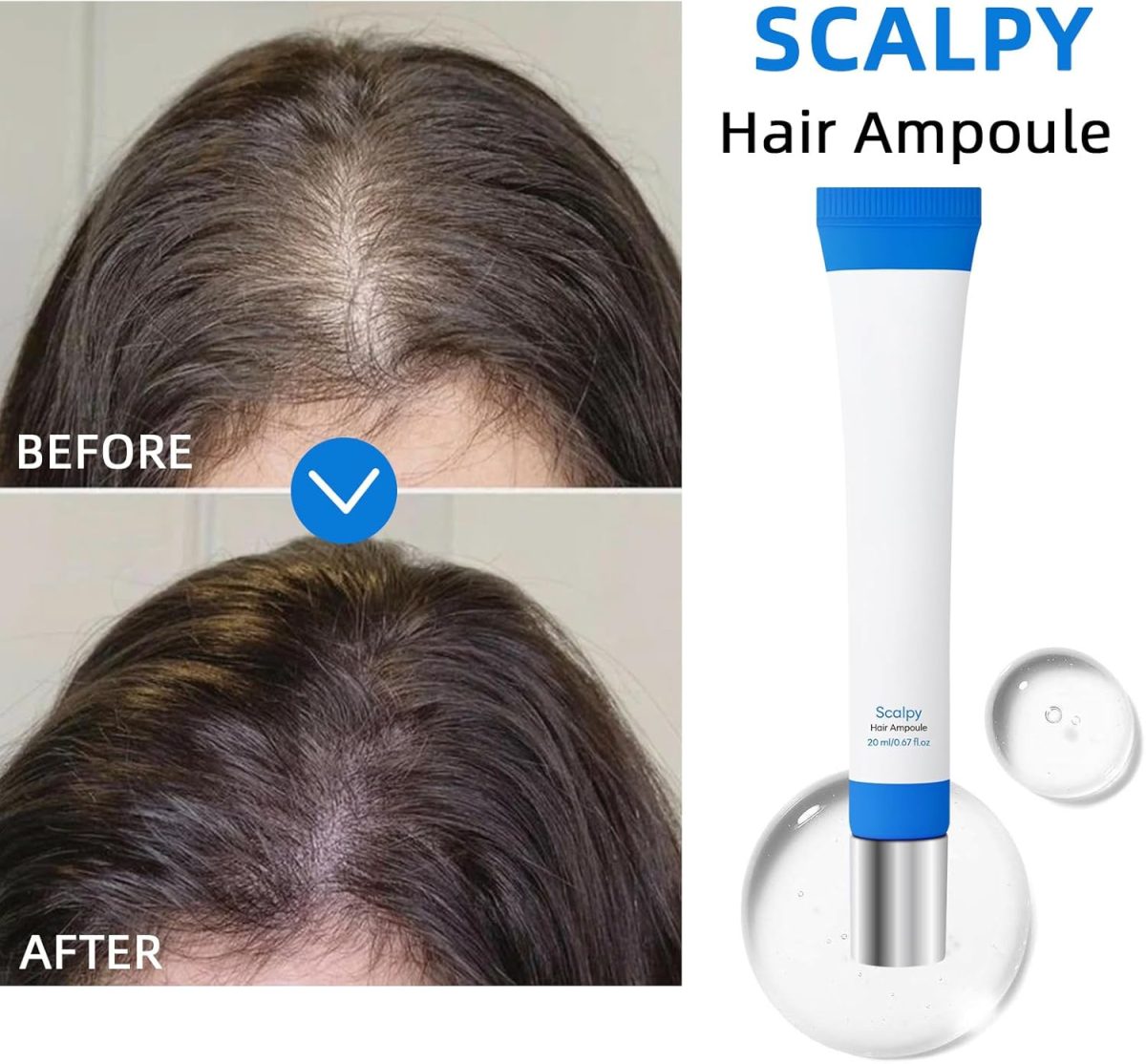 ⁦Luxury Spa Grade Hair Growth Seapurii Serum Scalp Massager for Long Hair⁩ - الصورة ⁦5⁩