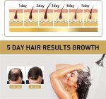 ⁦GIONAR Sakura Japanese Shampoo, Sakura Hair Growth Shampoo, Sakura Shampoo and Conditioner Japanese, Sakura Hair Growth Japan's No. 1 Shampoo, Japan Evening Sakura Amino Acid Shampoo (1set)⁩ - الصورة ⁦3⁩
