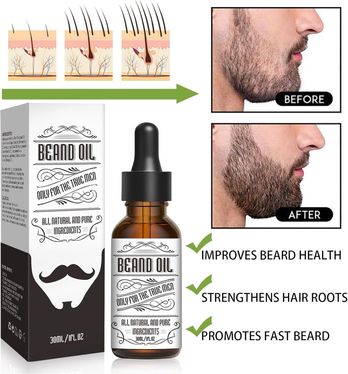 ⁦Beard Growth Serum Kit, Azonee Organic Beard Oil with Tea Tree and Jojoba, 0.5MM Derma Roller for Beard Growth, Nourishing Beard Grooming Set for Fuller and Thicker Beard⁩ - الصورة ⁦2⁩