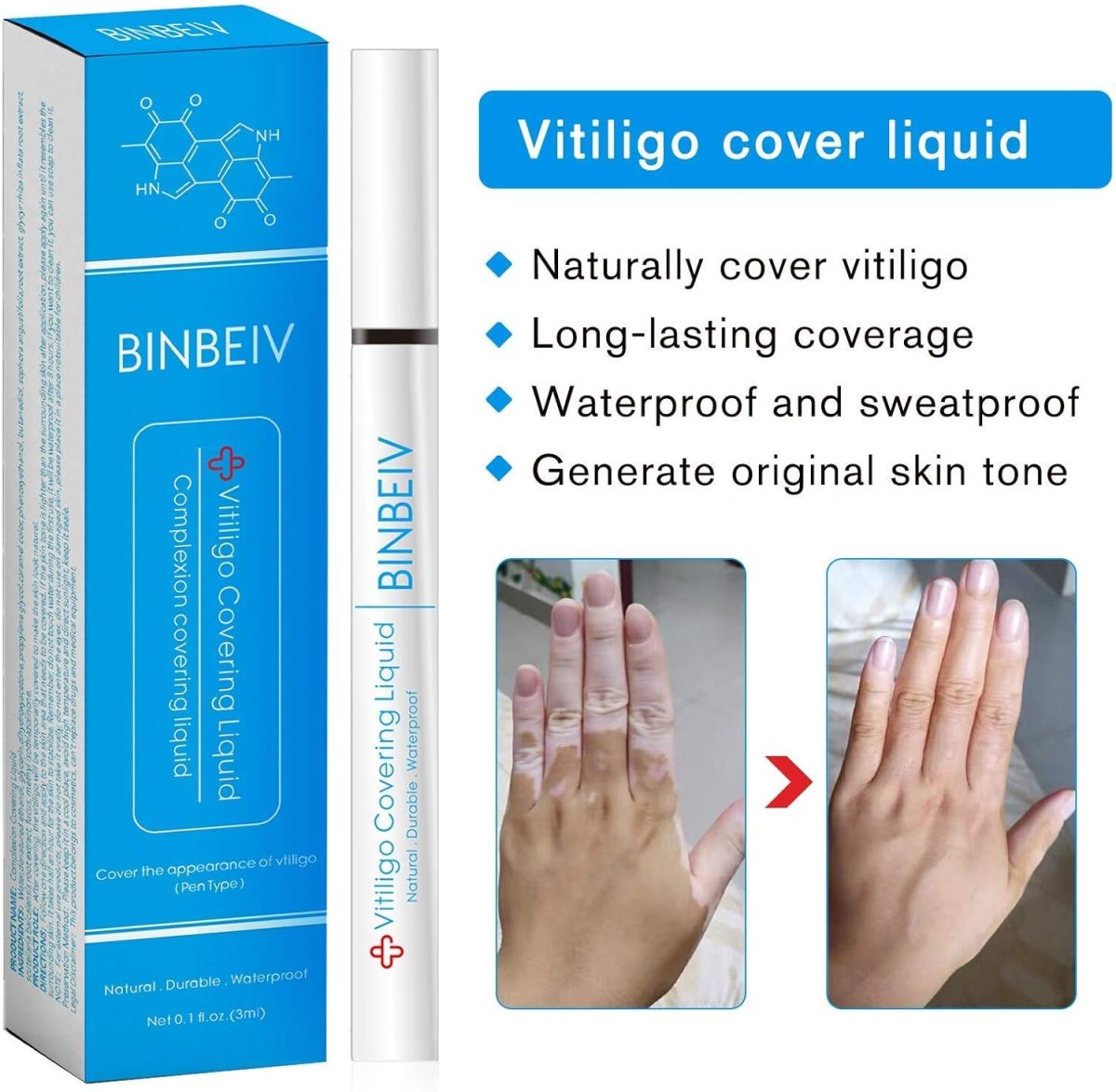 ⁦BINBEIV Vitiligo Cosmetic Camouflage Liqui, Cover appearance of Skin Depigmentation, Natural-Durable-Waterproof, Makeup Cover Waterproof, Used on face, hands and body⁩ - الصورة ⁦3⁩