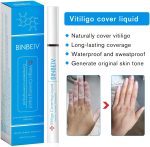 ⁦BINBEIV Vitiligo Cosmetic Camouflage Liqui, Cover appearance of Skin Depigmentation, Natural-Durable-Waterproof, Makeup Cover Waterproof, Used on face, hands and body⁩ - الصورة ⁦3⁩