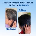 ⁦FEGPLUS Rosemary Beard & Hair Serum (50ml), Rosemary Extract Serum Hair Spray, Minoxidil 5% Solution for Hair and Beard⁩ - الصورة ⁦8⁩