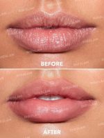 ⁦Sheglam Good Times Roll Ball Lip Oil-Life's a Party⁩ - الصورة ⁦3⁩