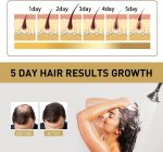 ⁦2023 New Sakura Japanese Shampoo, Sakura Hair Growth Japan'S No. 1 Shampoo, Sakura Shampoo and Conditioner Japanese, for Hair Loss, Volumizing & Moisturizing (Shampoo)⁩ - الصورة ⁦6⁩