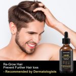 ⁦Soti Minoxidil 5% Hair Growth, Hair Loss Regrowth Serum. Made in USA! Dermatologists Recommended. Ginseng and Biotin Extra Strength Formula (3 Pack)⁩ - الصورة ⁦6⁩