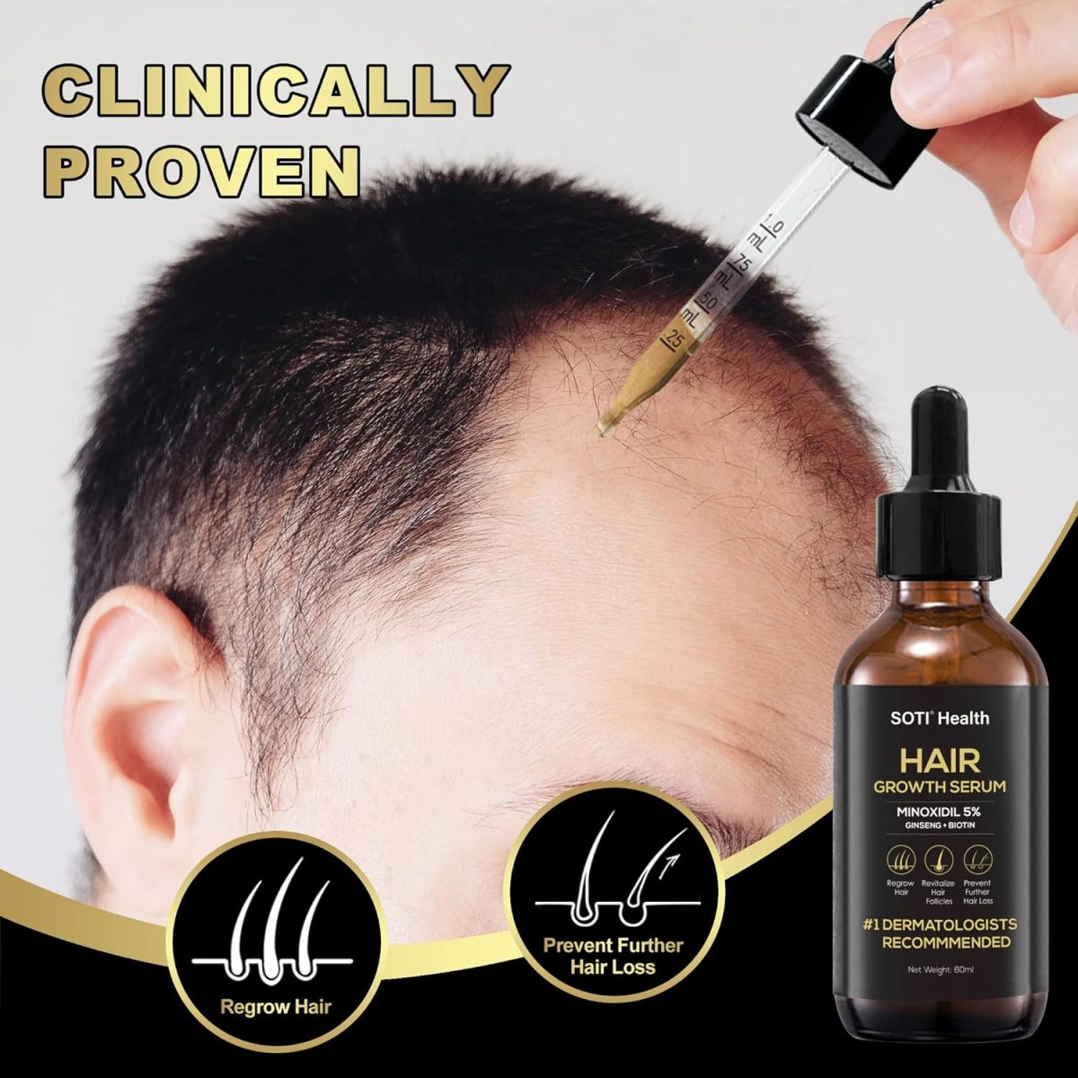 ⁦Soti Minoxidil 5% Hair Growth, Hair Loss Regrowth Serum. Made in USA! Dermatologists Recommended. Ginseng and Biotin Extra Strength Formula (3 Pack)⁩ - الصورة ⁦8⁩