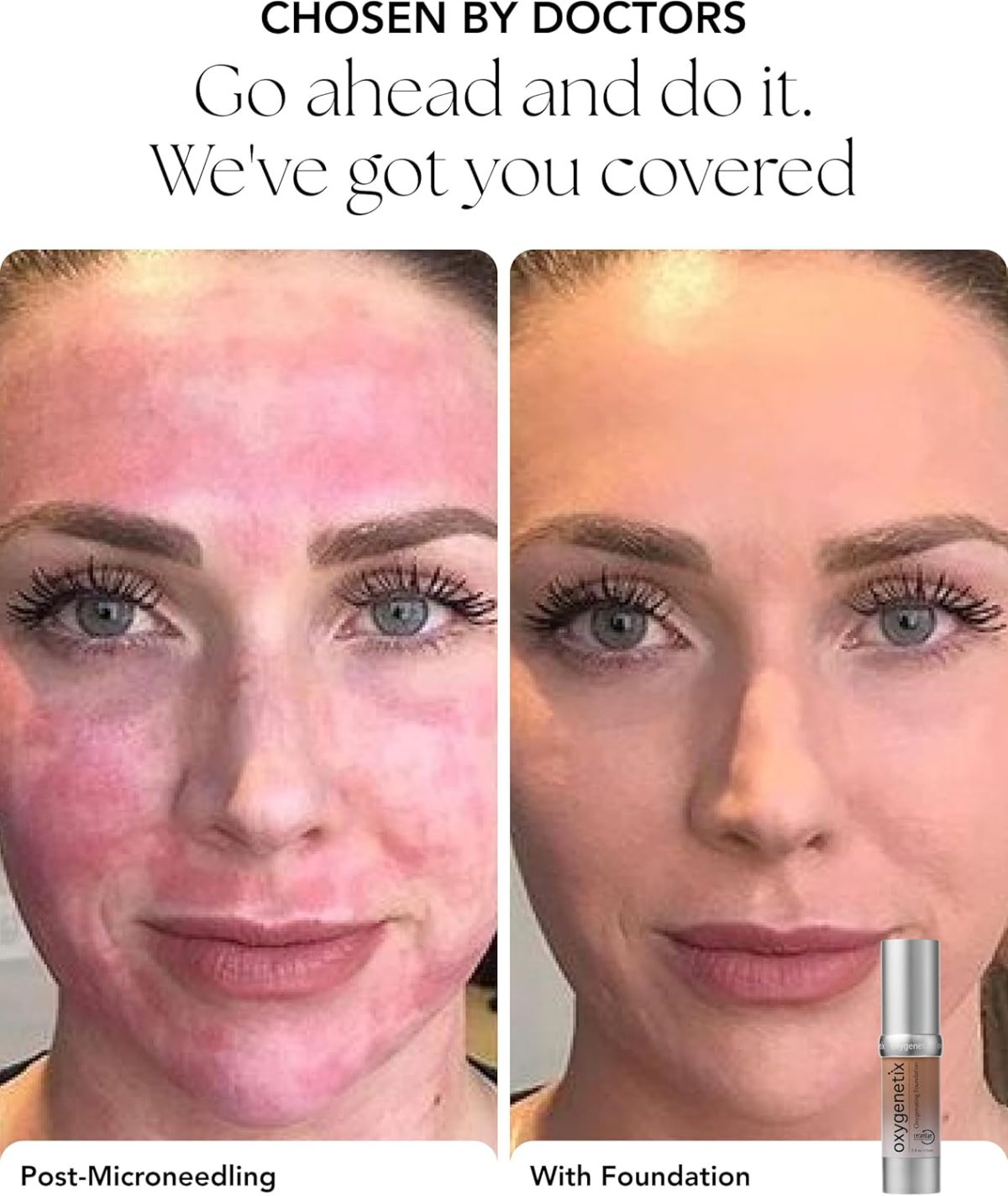 ⁦Oxygenetix Oxygenating Foundation - 15ml - Ivory⁩ - الصورة ⁦3⁩