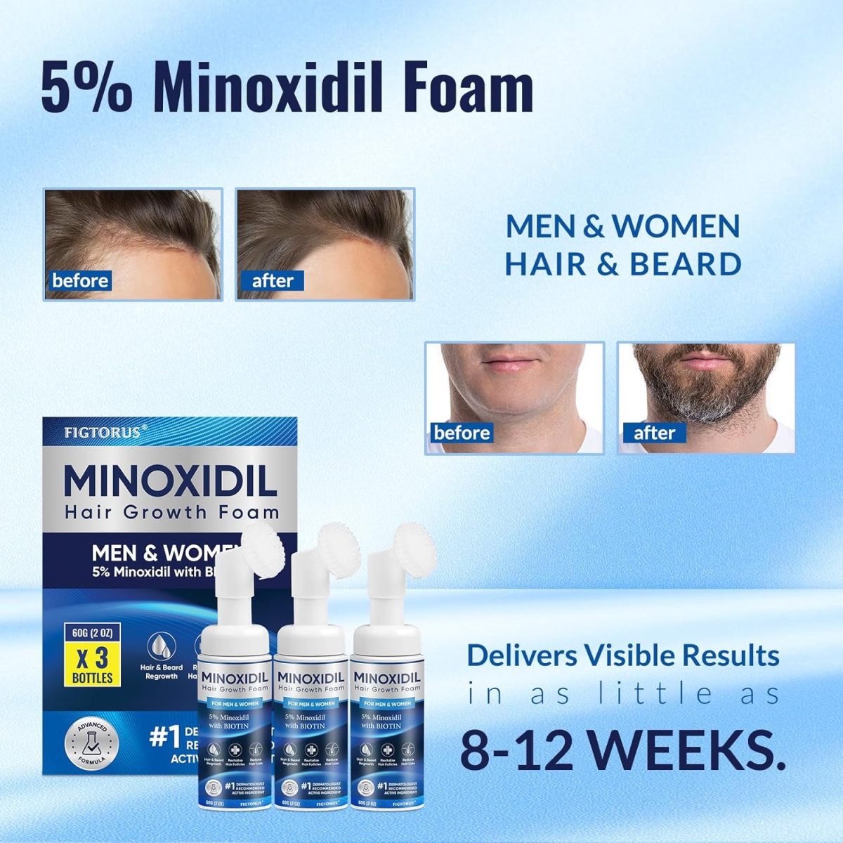 ⁦FIGTORUS 5% Minoxidil Foam, Unisex Adult, Blue, Unscented, 3 Pack, Hair and Beard Growth, 6 Gram⁩ - الصورة ⁦4⁩