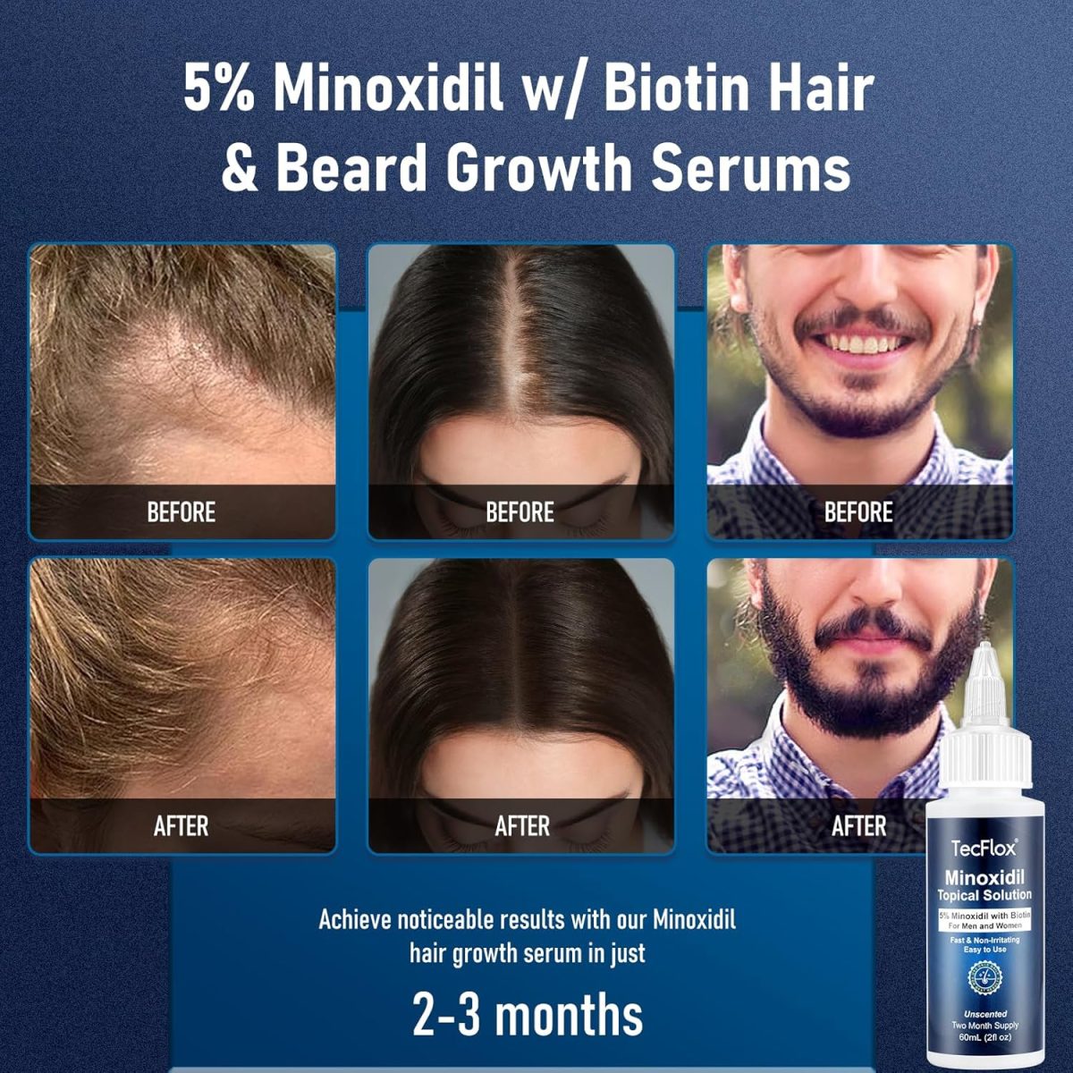 ⁦5% Minoxidil for Men & Women Hair with Biotin, Minoxidil for Men Beard,Tecflox Minoxidil Beard Growth Oil, Minoxidil Hair Growth Serum, 2-Pack, Total 4fl oz for 4 Months, Hair Growth Oil Unisex⁩ - الصورة ⁦2⁩