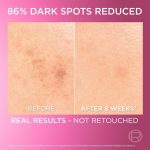 ⁦سيروم جليكوليك برايت اللامع الفوري من لوريال باريس، 30 ملليلتر، لكل أنواع البشرة، للجنسين⁩ - الصورة ⁦4⁩