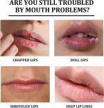 ⁦مجموعة زيت الشفاه⁩ - الصورة ⁦3⁩