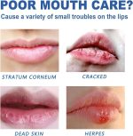 ملمع شفاه لتكبير الشفاه، زيت شفاه شفاف عالي اللمعان، معزز صحي ومرطب، ملمع شفاه شفاف، ملمع شفاه شفاف، منتجات ال/اي بي، بلسم ملمع شفاه - الصورة 6