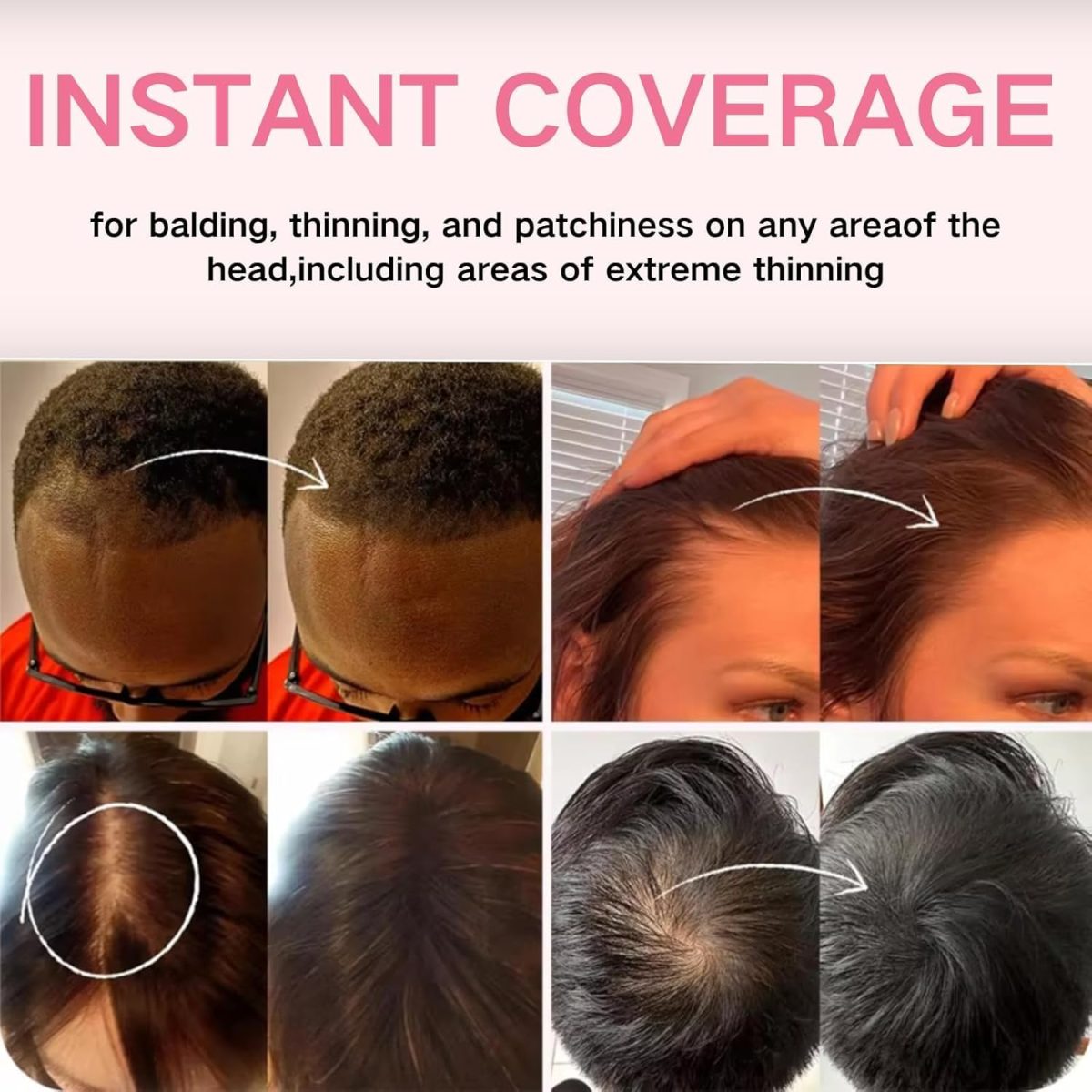 ⁦Paporich Hairline Powder,Thin Hair Root Dye Touch Up Root Touch Up Powder,Hair Powder Stick for Hairline Shadow,Windproof & Sweatproof Hairline Powder for Women & Men (Dark Brown)⁩ - الصورة ⁦3⁩
